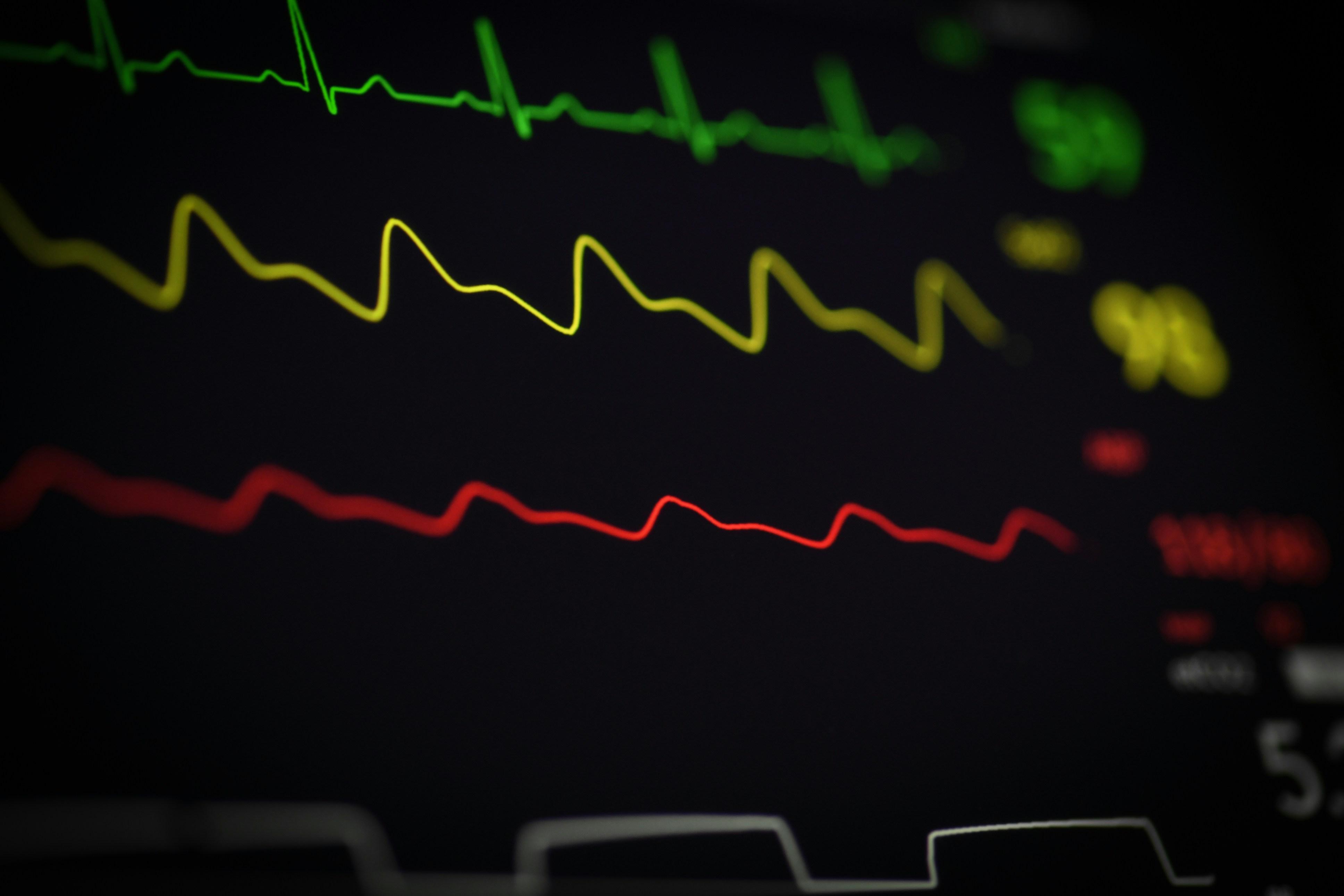 Tools of the Trade: Choosing the Right Heart Rate Monitor