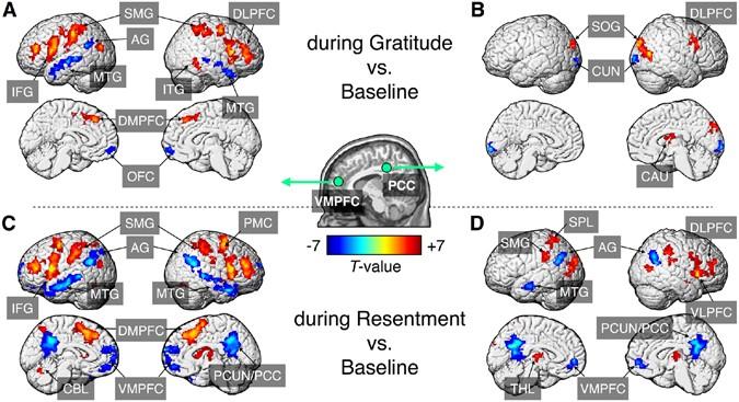 The Neuroscience of Gratitude: How Appreciation Alters the Brain